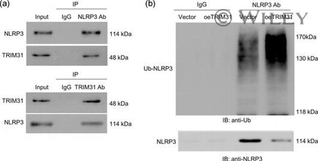 TRIM31 Antibody in Western Blot, Immunoprecipitation (WB, IP)