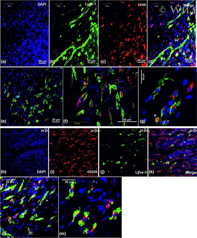 CD169 Antibody in Immunocytochemistry (ICC/IF)