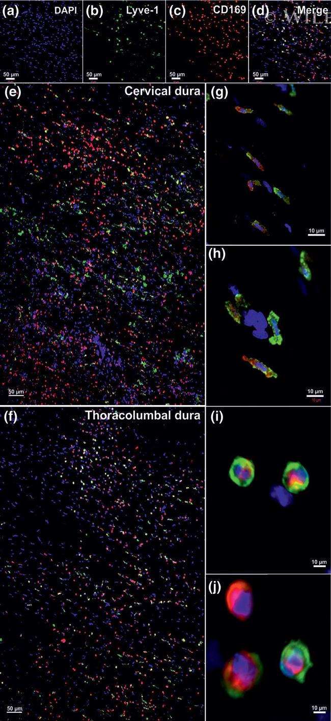 CD169 Antibody in Immunocytochemistry (ICC/IF)