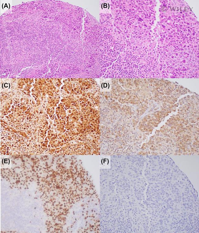 Survivin Antibody in Immunohistochemistry (IHC)