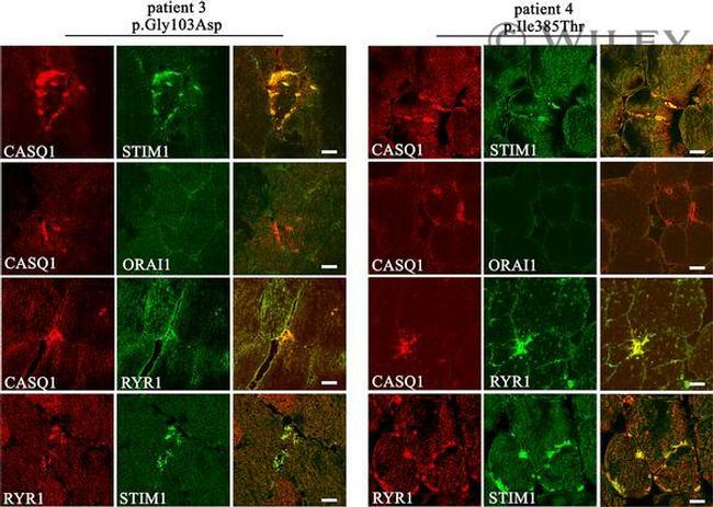 Calsequestrin Antibody in Immunocytochemistry (ICC/IF)