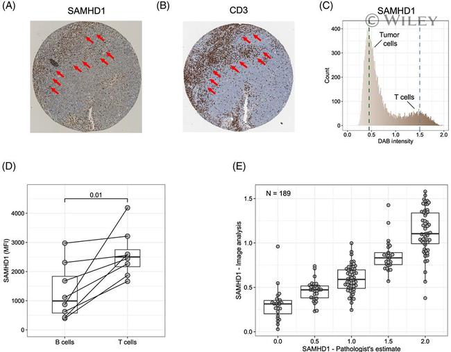 SAMHD1 Antibody in Immunohistochemistry (IHC)