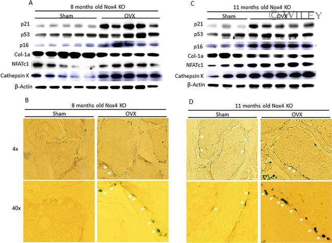 Collagen I Antibody in Western Blot (WB)