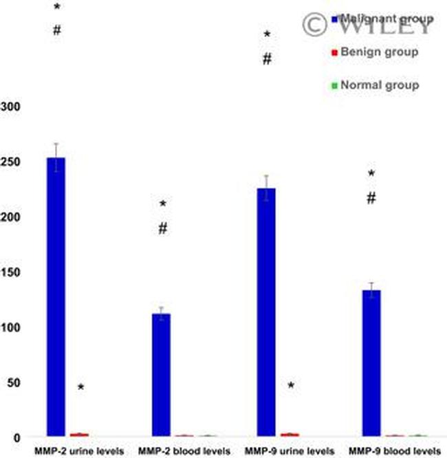 MMP9 Antibody in Western Blot (WB)