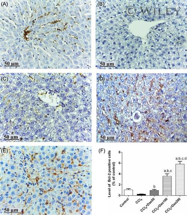 Bcl-2 Antibody in Immunohistochemistry (IHC)