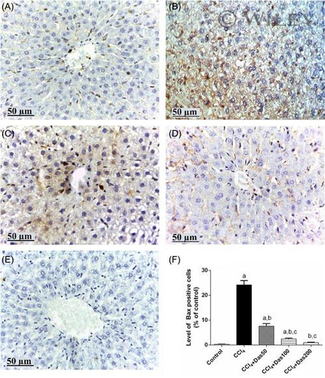 Bax Antibody in Immunohistochemistry (IHC)