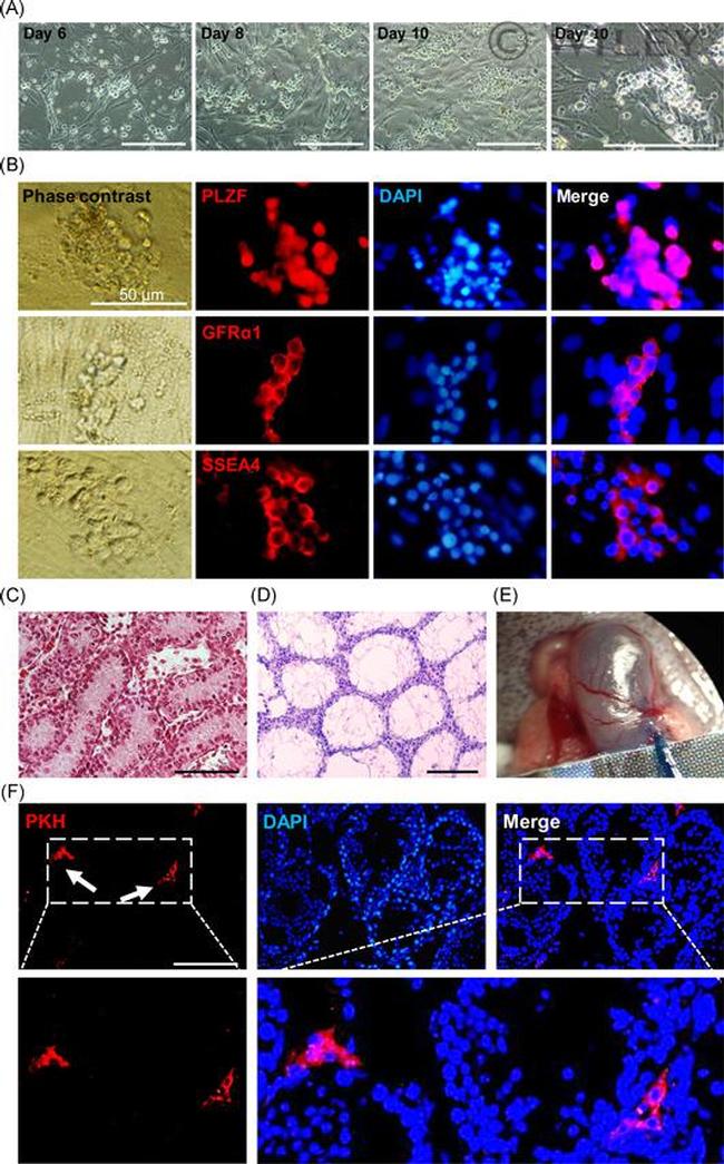 SSEA4 Antibody in Immunocytochemistry (ICC/IF)