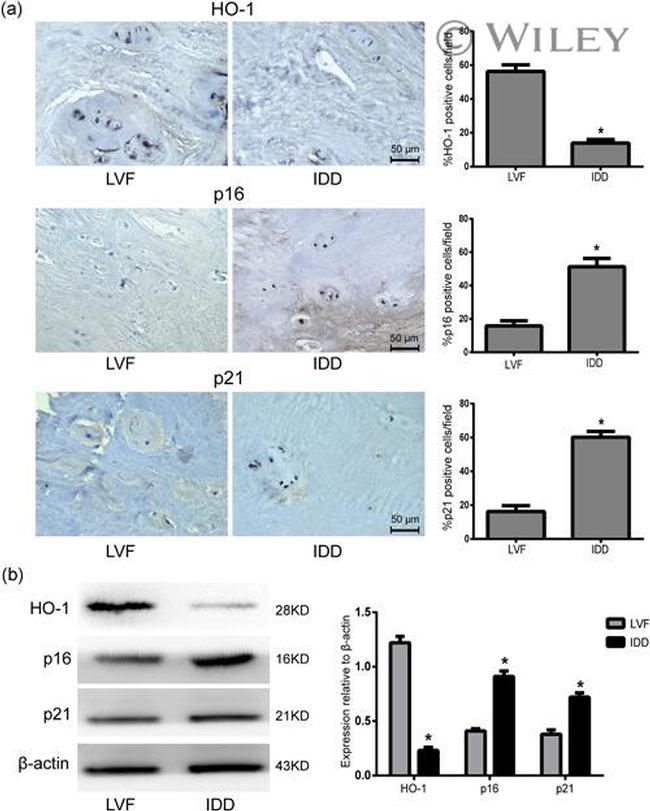 HMOX1 Antibody in Western Blot, Immunohistochemistry (WB, IHC)