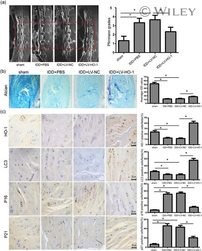 HMOX1 Antibody in Immunohistochemistry (IHC)