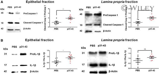 IL-1 beta Antibody in Western Blot (WB)