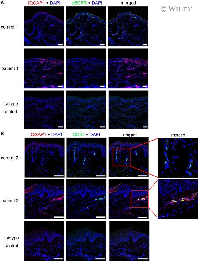 IQGAP1 Antibody in Immunocytochemistry (ICC/IF)