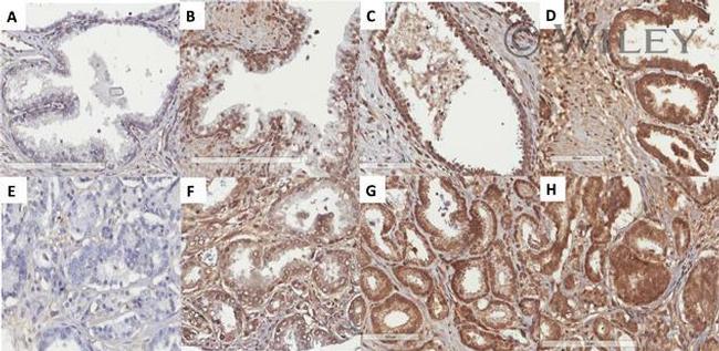 INSR Antibody in Immunohistochemistry (IHC)