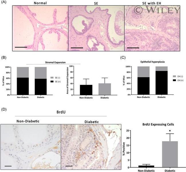 BrdU Antibody in Immunohistochemistry (IHC)