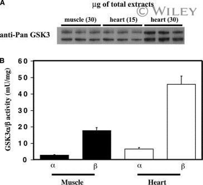 GSK3 alpha/beta Antibody in Western Blot, Immunoprecipitation (WB, IP)