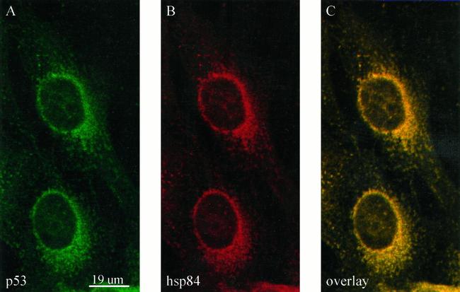 HSP90 beta Antibody in Immunocytochemistry (ICC/IF)