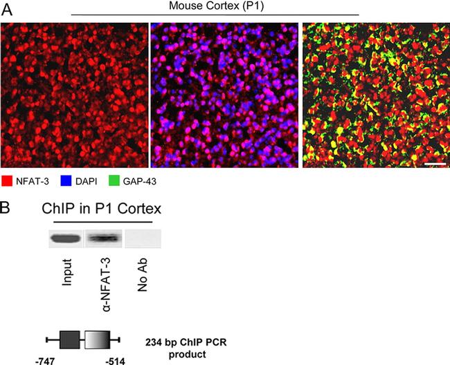 NFATC4 Antibody in Immunohistochemistry (IHC)