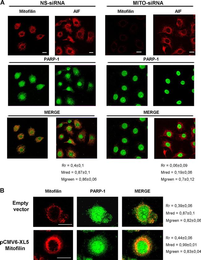 Mitofilin Antibody in Immunocytochemistry (ICC/IF)