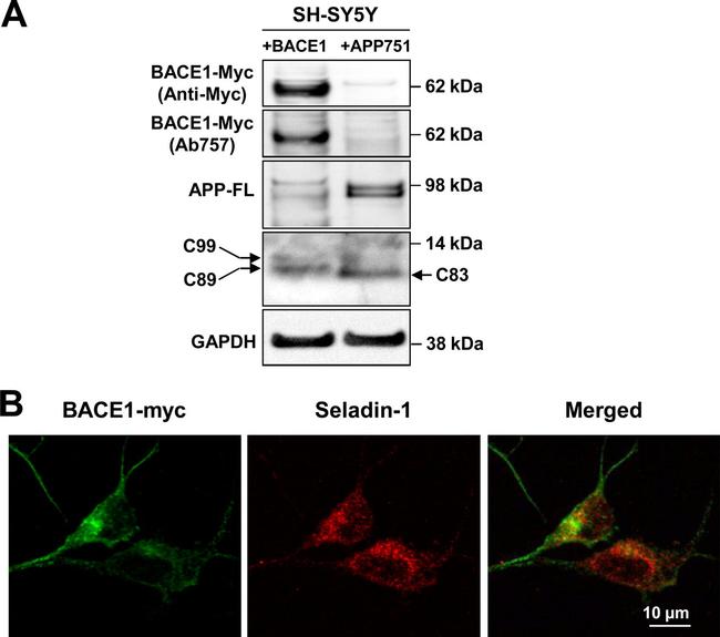 BACE1 Antibody in Western Blot (WB)