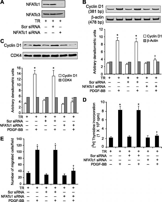 NFATC1 Antibody in Western Blot (WB)