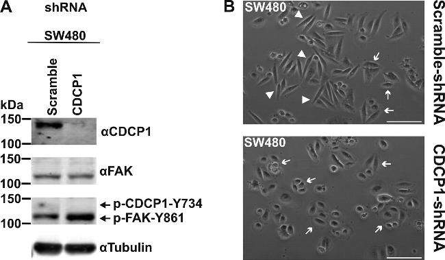 Phospho-FAK (Tyr861) Antibody in Western Blot (WB)