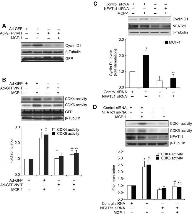 NFATC1 Antibody in Western Blot (WB)