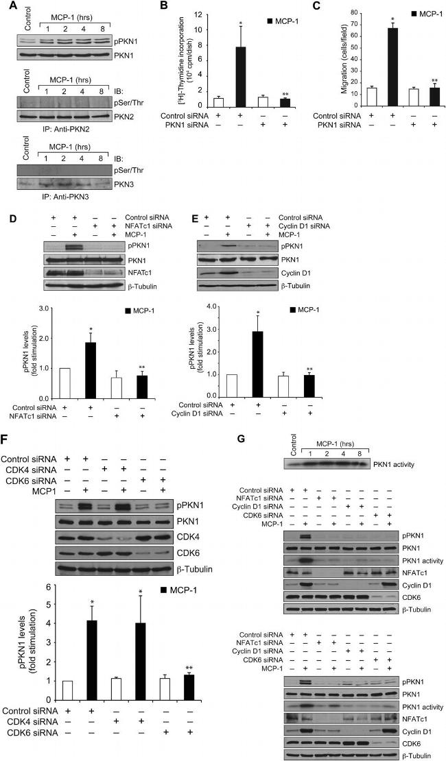 NFATC1 Antibody in Western Blot (WB)