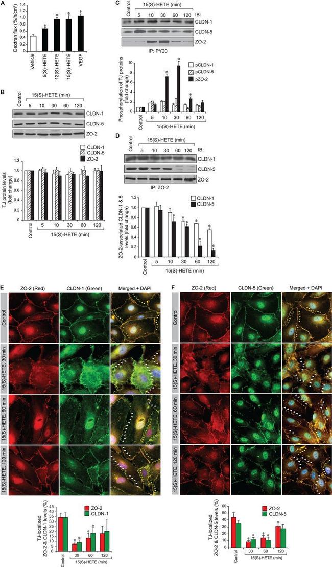 ZO-2 Antibody in Western Blot, Immunoprecipitation (WB, IP)