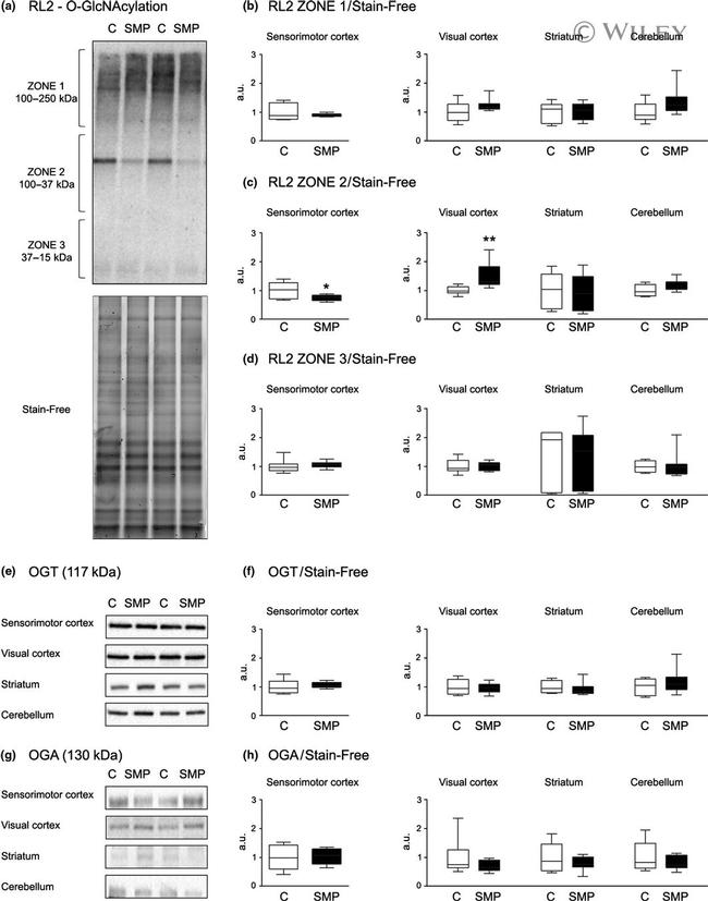 O-linked N-acetylglucosamine (O-GlcNAc) Antibody in Western Blot (WB)