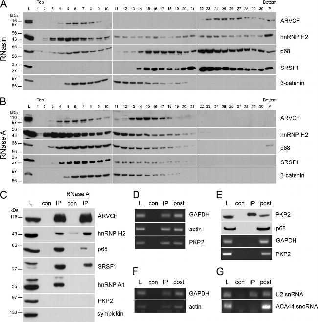 SRSF1 Antibody in Western Blot (WB)