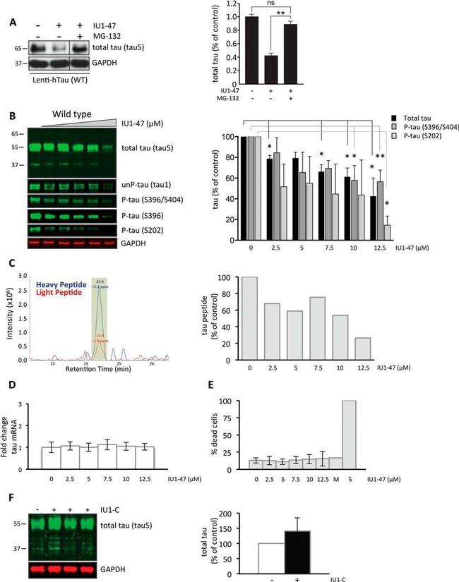 Phospho-Tau (Ser396) Antibody in Western Blot (WB)