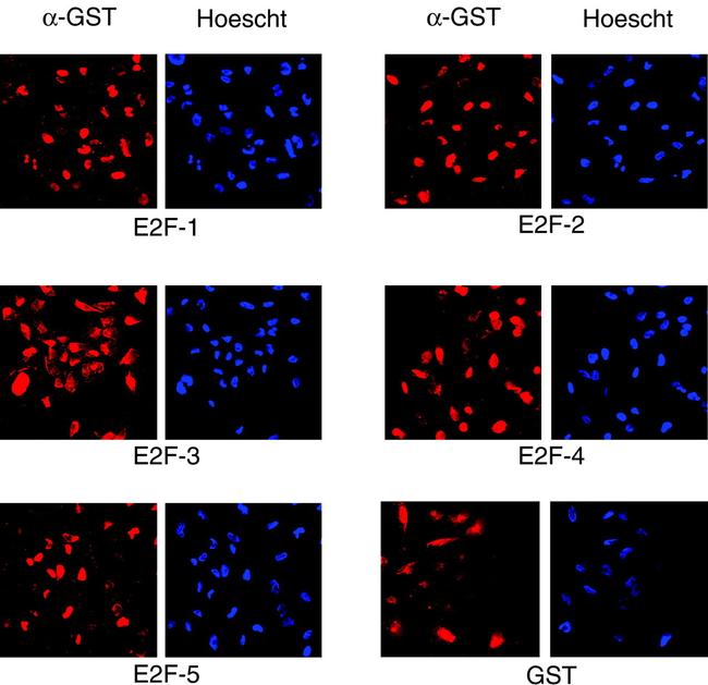 GST Tag Antibody in Immunocytochemistry (ICC/IF)