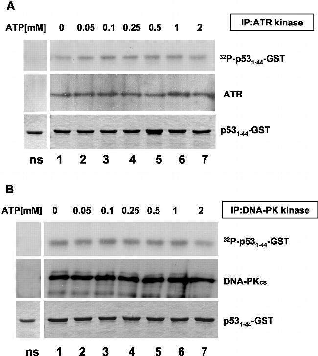 ATR Antibody in Western Blot, Immunoprecipitation (WB, IP)