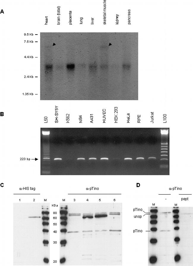 6x-His Tag Antibody in Western Blot (WB)