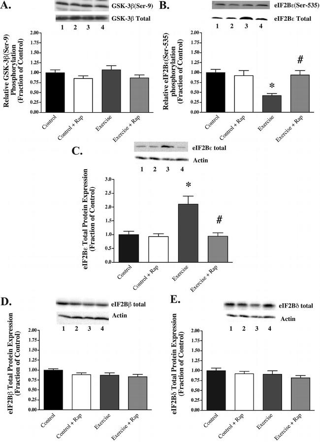 Phospho-eIF2b epsilon (Ser539) Antibody in Western Blot (WB)