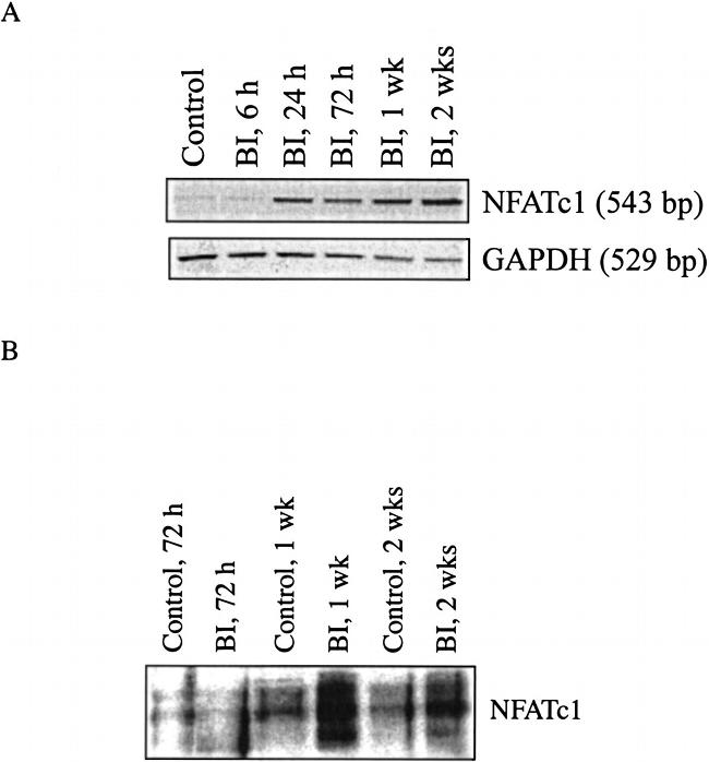 NFATC1 Antibody in Western Blot (WB)