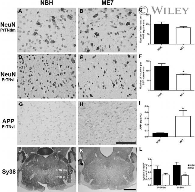 Amyloid Precursor Protein Antibody in Immunohistochemistry (Paraffin) (IHC (P))