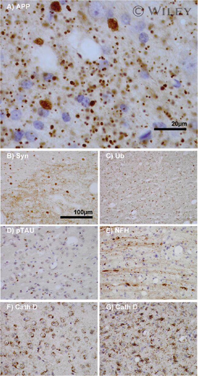 Amyloid Precursor Protein Antibody in Immunohistochemistry (IHC)