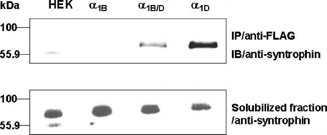 SNTB2 Antibody in Western Blot (WB)