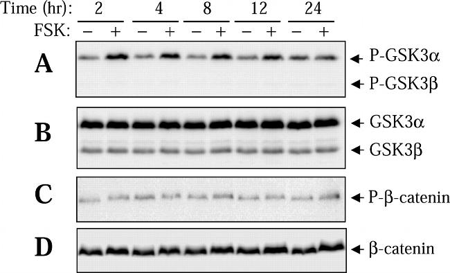 GSK3 alpha/beta Antibody in Western Blot (WB)