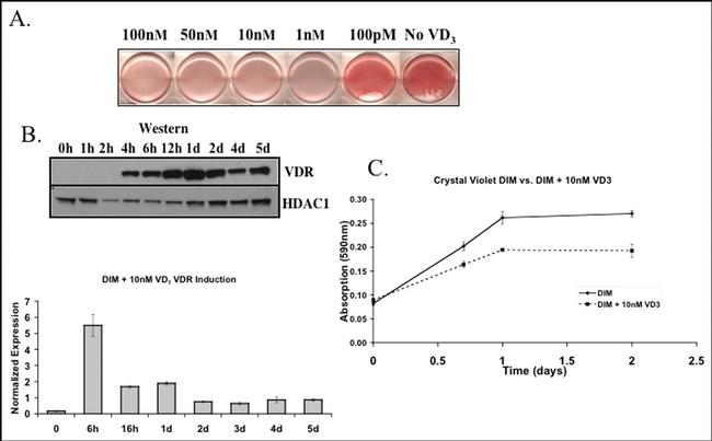 VDR Antibody in Western Blot (WB)