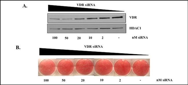 VDR Antibody in Western Blot (WB)