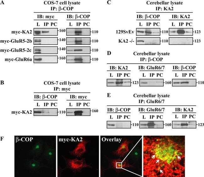 beta COP Antibody in Western Blot, Immunocytochemistry, Immunoprecipitation (WB, ICC/IF, IP)