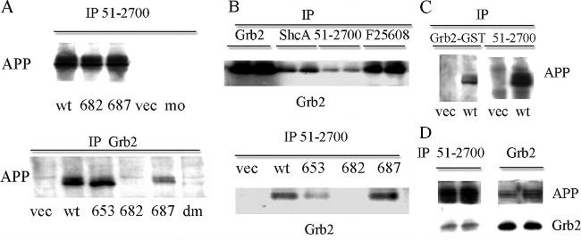 beta Amyloid Antibody in Western Blot, Immunoprecipitation (WB, IP)