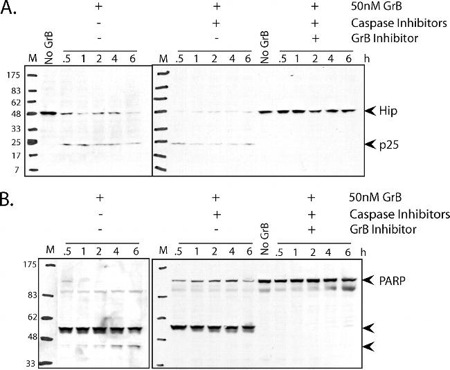 HIP Antibody in Western Blot (WB)