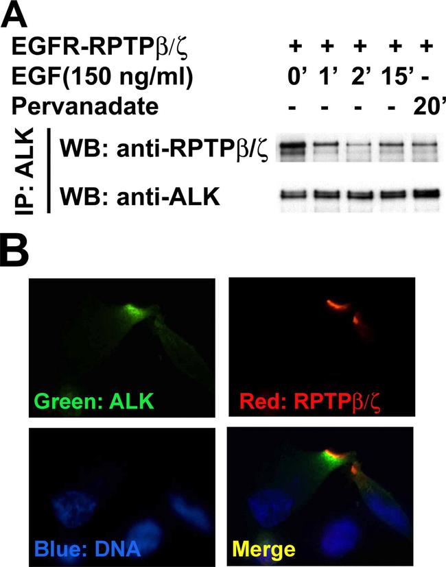 ALK Antibody in Western Blot, Immunocytochemistry, Immunoprecipitation (WB, ICC/IF, IP)