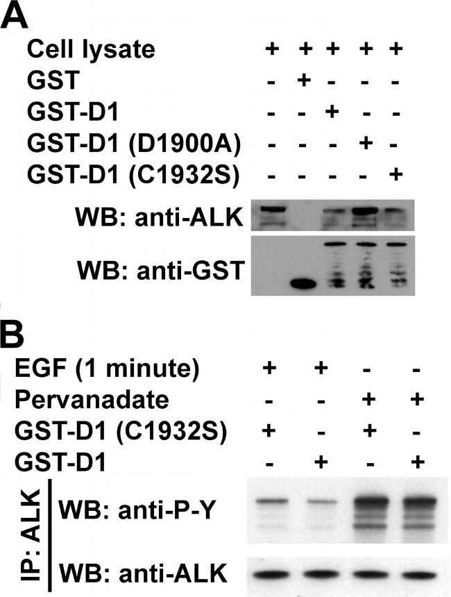 ALK Antibody in Western Blot, Immunoprecipitation (WB, IP)