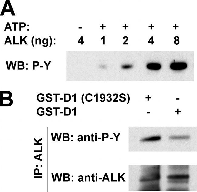 ALK Antibody in Western Blot, Immunoprecipitation (WB, IP)