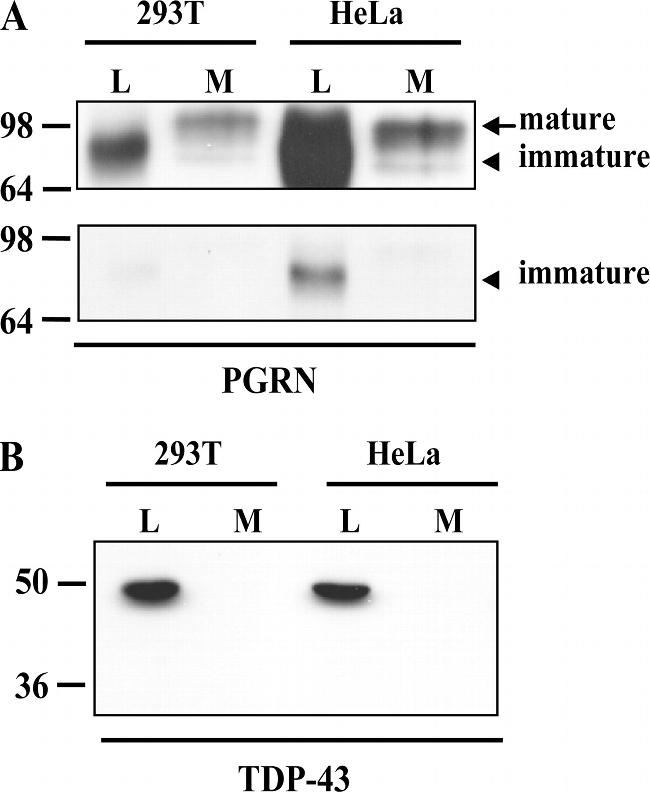 PCDGF Antibody in Western Blot (WB)