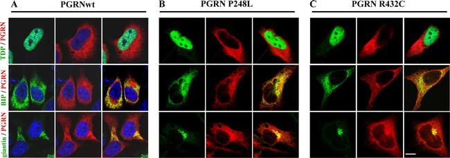 PCDGF Antibody in Immunocytochemistry (ICC/IF)