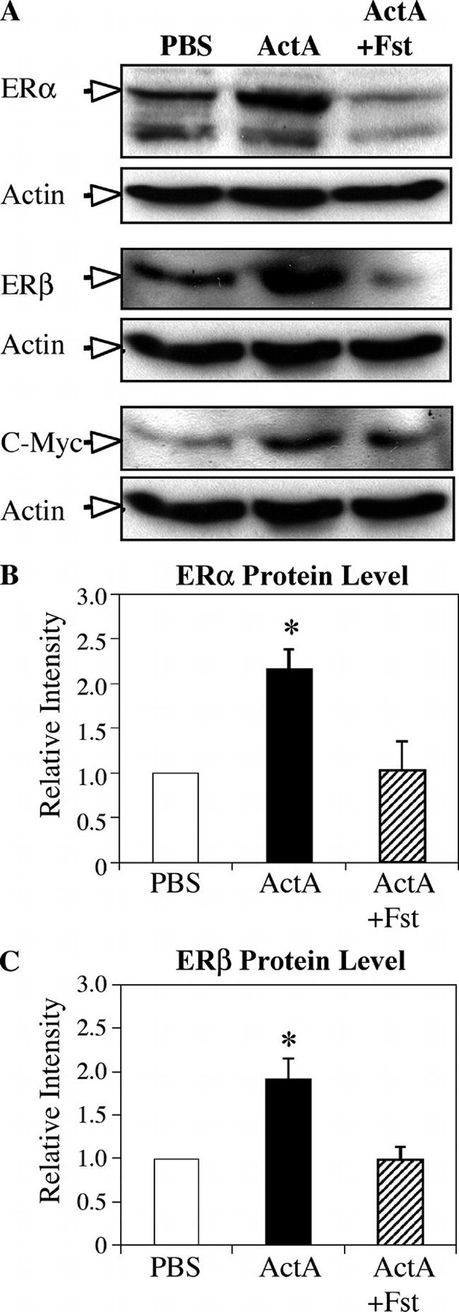 Estrogen Receptor beta Antibody in Western Blot (WB)